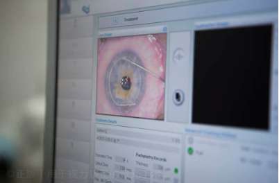 激光手术矫正视力对眼睛到底有没有伤害？